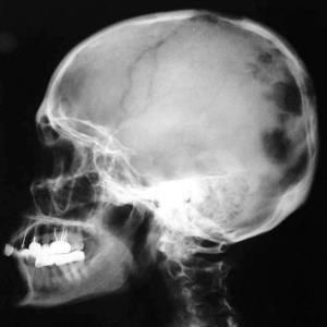 an image representing the X-ray Cassettes, Screens and Film category